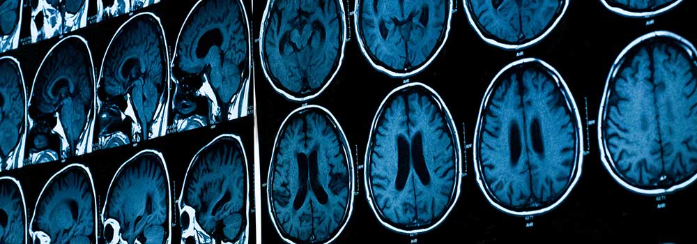 MRI-Viewer-Online-at-ArchitecturesLab