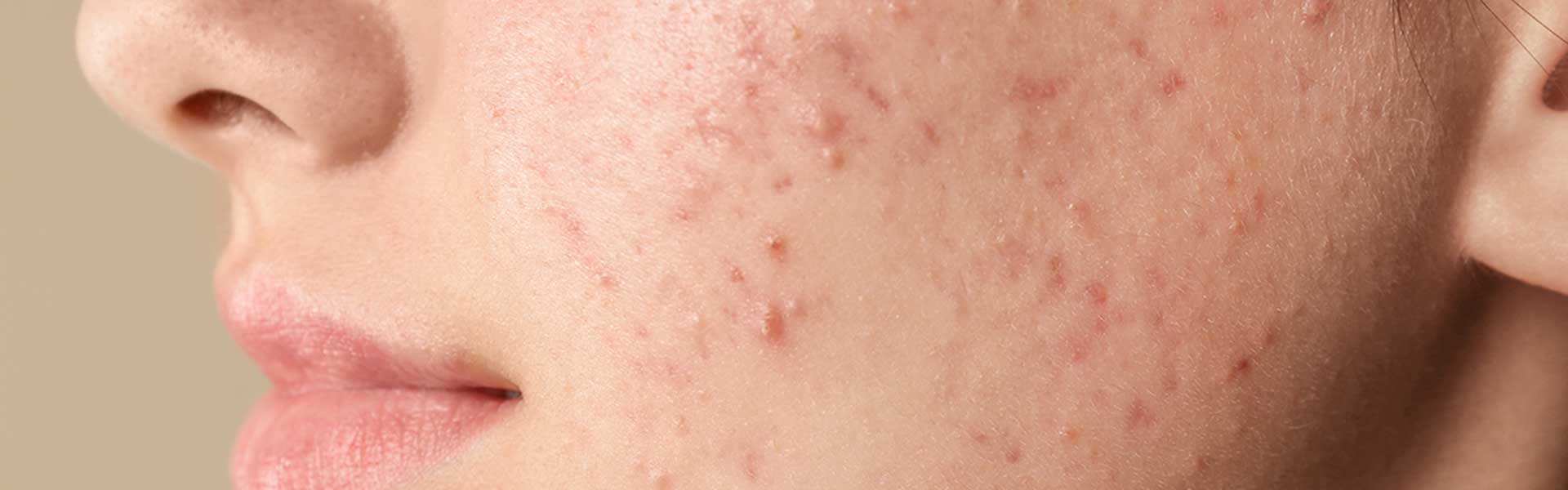 Tips To Prevent Itching After a Bath with Ease Architectures Lab