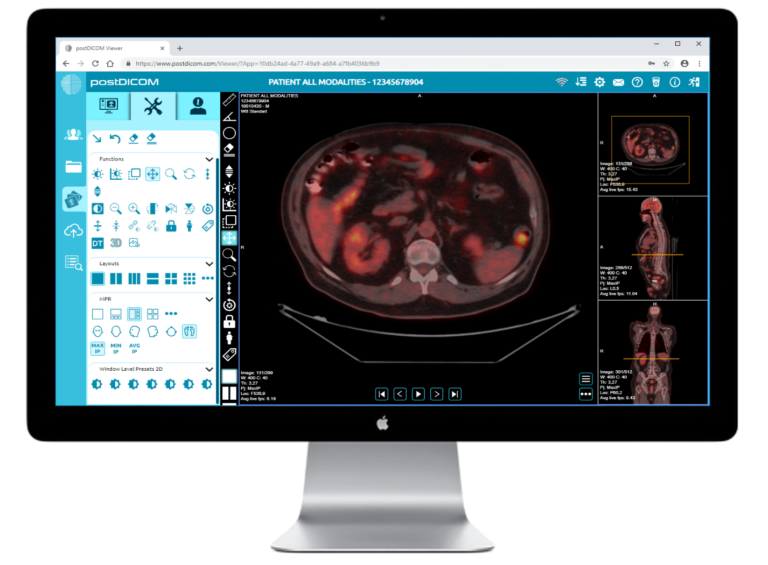 Instantly Access and Analyze Medical Images: Meet the Game-Changing Online DICOM Viewer