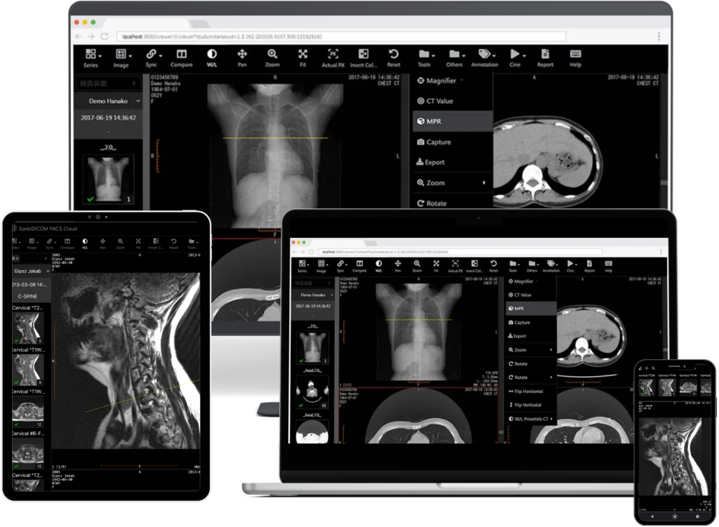 DICOM viewer online